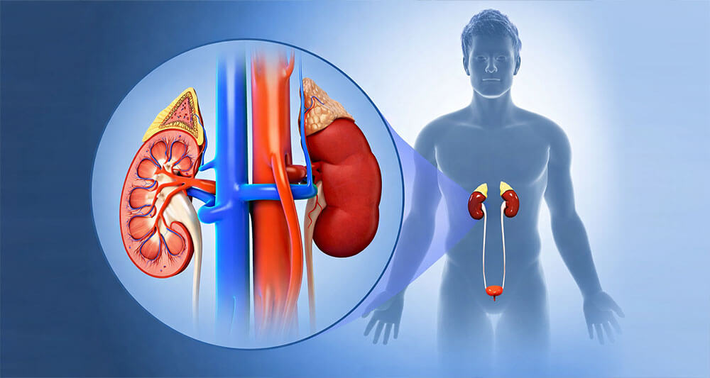 Acute Kidney Injury
