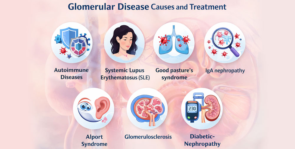 Glomerular Diseases